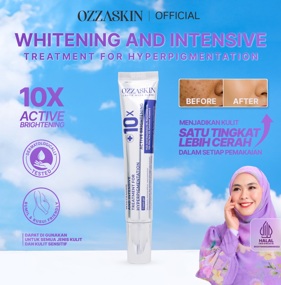 Ozzaskin Whitening & Intensive Treatment For Hyperpigmentation foto 3