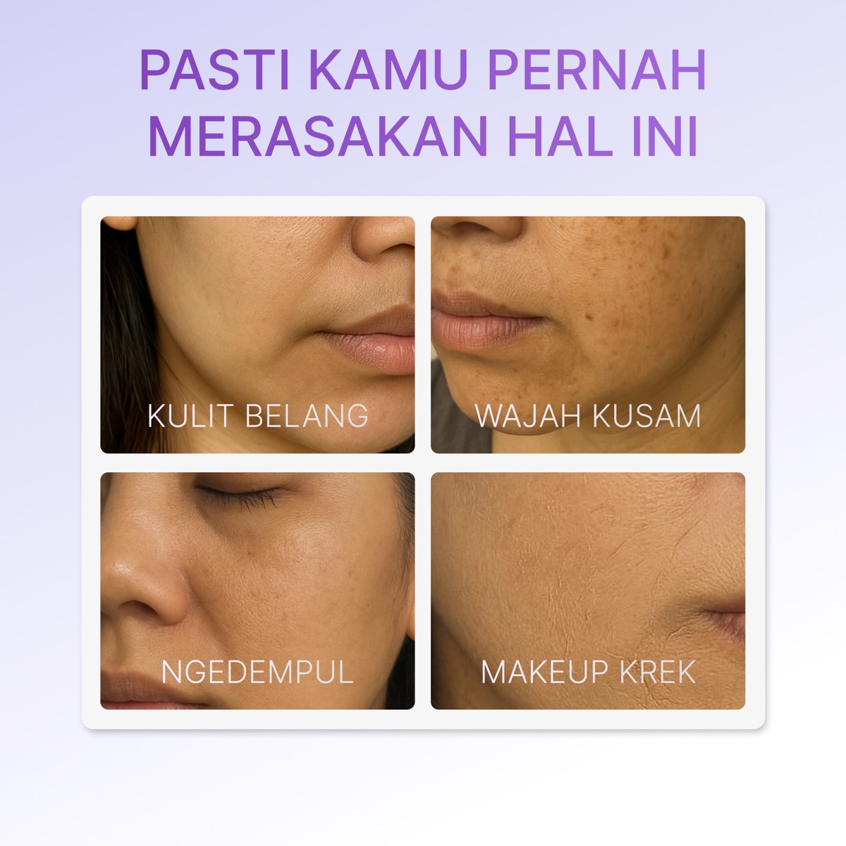 Ozzaskin Whitening & Intensive Treatment For Hyperpigmentation foto 4