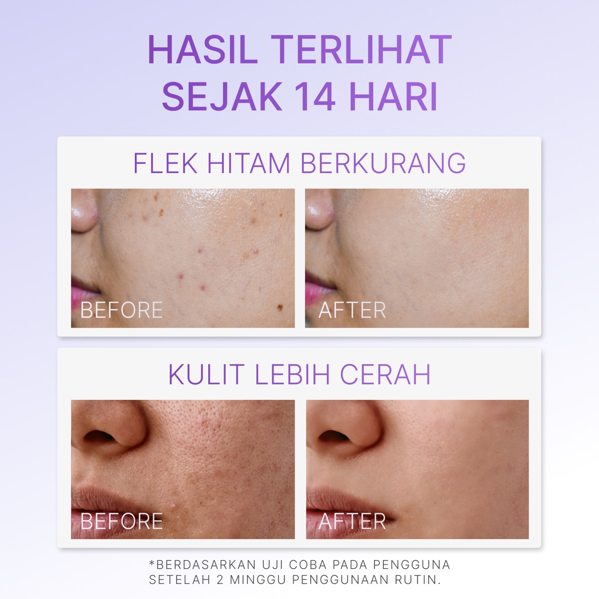 Ozzaskin Whitening & Intensive Treatment For Hyperpigmentation foto 7
